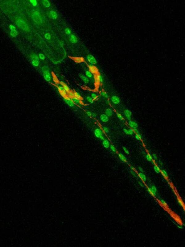 Microscopía de un tejido con células verdes y naranjas, mostrando detalles microscópicos de una estructura biológica.