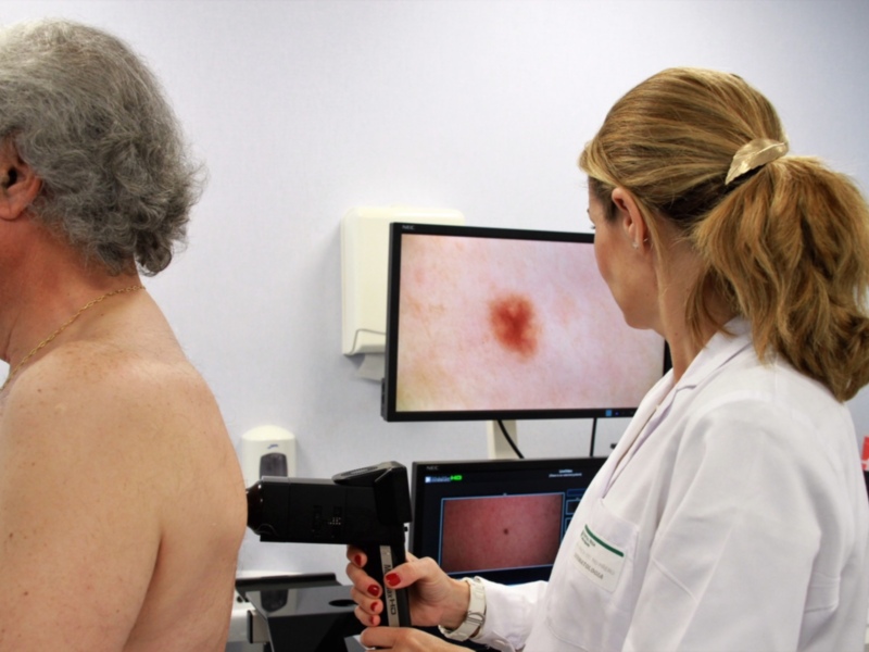 Doctora examinando la piel de un paciente con un dermatoscopio en un consultorio médico.